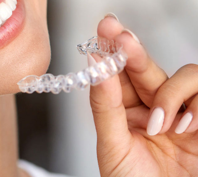 Invisalign